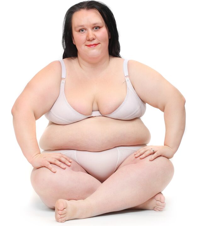 Ženska s prekomerno telesno težo